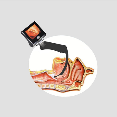 360 Degree All Sight LCD Ιατρικό άκαμπτο σετ λαρυγγοσκοπίου βίντεο Επαναφορτιζόμενη μπαταρία