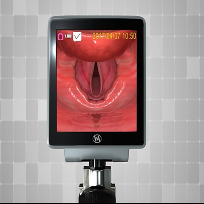 Κάρτα SD 32 GB Video Assisted Laryngoscope for Intubation 225g