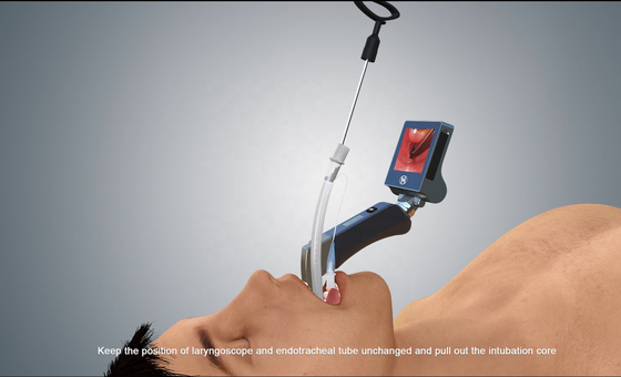 3 Intubation ίντσας LCD μίας χρήσης τηλεοπτικό λαρυγκοσκόπιο 1280*720 Px