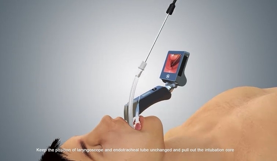 Intubation εναέριων διαδρόμων επαναχρησιμοποιήσιμο άκαμπτο τηλεοπτικό λαρυγκοσκόπιο με 5 μίας χρήσης λεπίδες